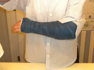 Traci's arm in a cast after surgery